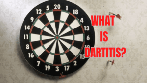 Dartitis in darts, the condition no player wants to befall them